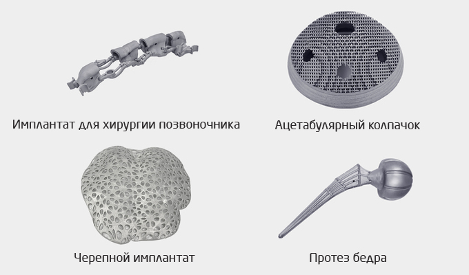 Ортопедические изделия из металла